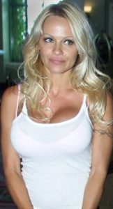 Pamela Anderson's Breast Augmentations Now and Then | Daniel Man MD | Breast Implant | Boca Raton, FL