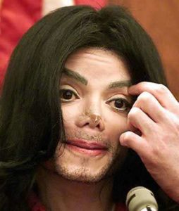 Michael Jackson Nose Jobs | Daniel Man MD | Rhinoplasty | Boca Raton, FL