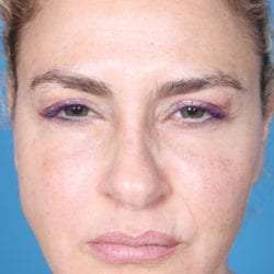 01after-ormifront1-jpg