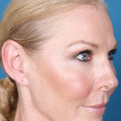 01after-refit-dr-daniel-man-ksside1-jpg