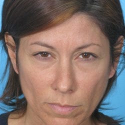 01after-taanfront1-jpg