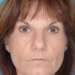 01before-eco-dr-daniel-man-nefront-jpg