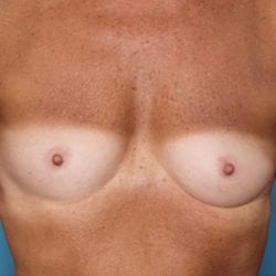 01before-locofront1-jpg