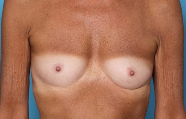 01before-locofront1-jpg