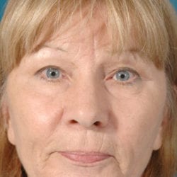 01before-raszfront-jpg