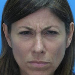 01before-taanfront1-jpg