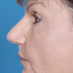 02after-eco-dr-daniel-man-neside1-jpg