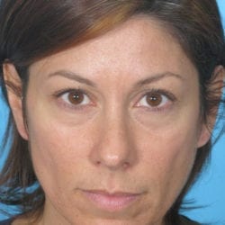 02after-taanfront2-jpg