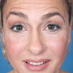 02before-ormifront2-jpg