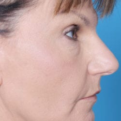 03after-eco-dr-daniel-man-neside2-jpg