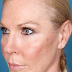 03after-refit-dr-daniel-man-ksside3-jpg