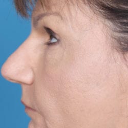 04after-eco-dr-daniel-man-neside3-jpg