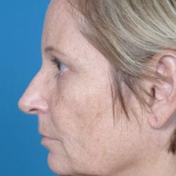 04before-angrside3-jpg