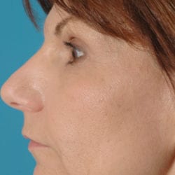 04before-eco-dr-daniel-man-neside3-jpg