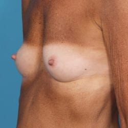 04before-locoside3-jpg