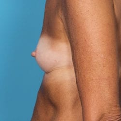 05before-locoside4-jpg