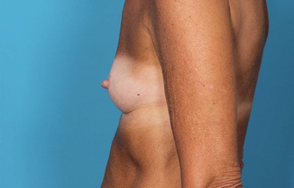 05before-locoside4-jpg