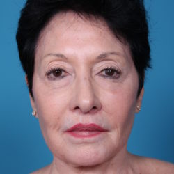 bdafterfront-jpeg-jpg