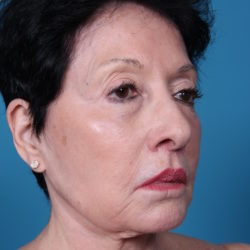 bdafterquater-jpeg-jpg