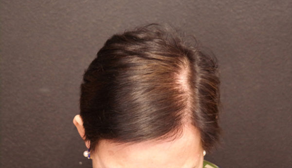 bansal-before-and-after-together-watermark-4-after-1-jpg