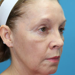 clhaquarteraedit-jpg