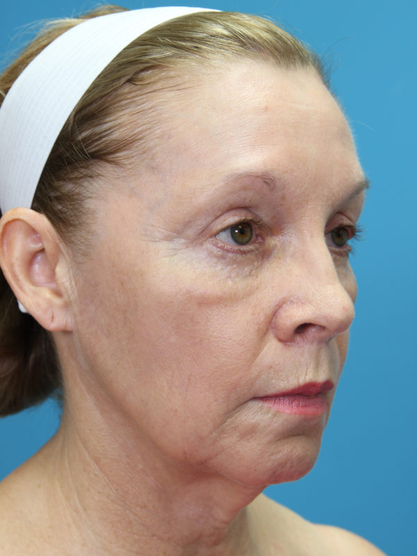 clhaquarteraedit-jpg