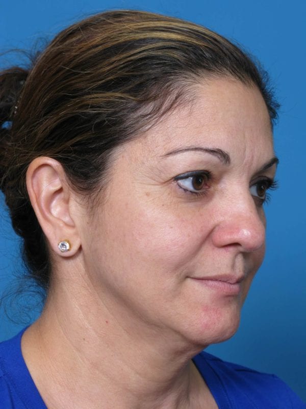 correa-anna-20111213143616109-20120424174644656-jpg