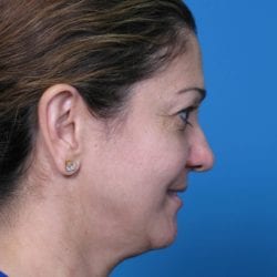 correa-anna-20111213143616109-20120424174645640-jpg