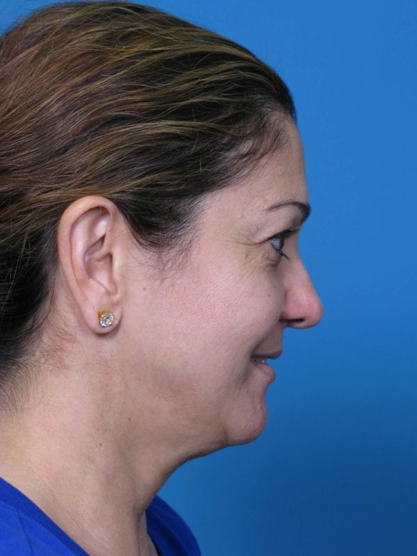 correa-anna-20111213143616109-20120424174645640-jpg