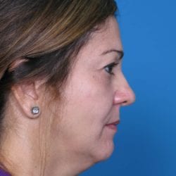 correa-anna-20111213143616109-20120810091455703-jpg