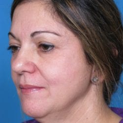 correa-anna-20111213143616109-20120810091456609-jpg