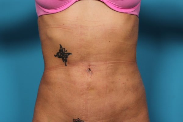 dg-afterfront-jpeg-jpg