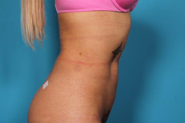 dg-afterleft-jpeg-jpg