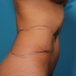 dg-beforeleft-jpeg-2-jpg