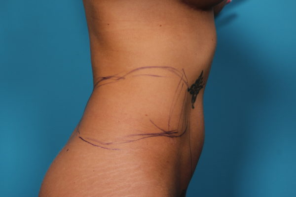 dg-beforeleft-jpeg-2-jpg