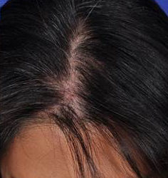 dibernado-ba-11-watermark-right-jpg