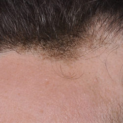 dibernardo-ba-12-watermark-2-1-jpg