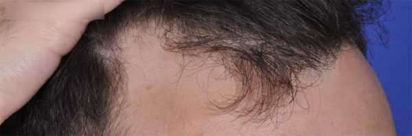 dibernardo-ba-12-watermark-top-1-jpg