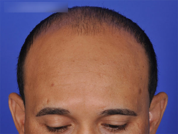 dibernardo-ba-3-watermark-3-top-1-jpg