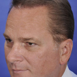 dibernardo-ba-9-watermark-right-1-jpg