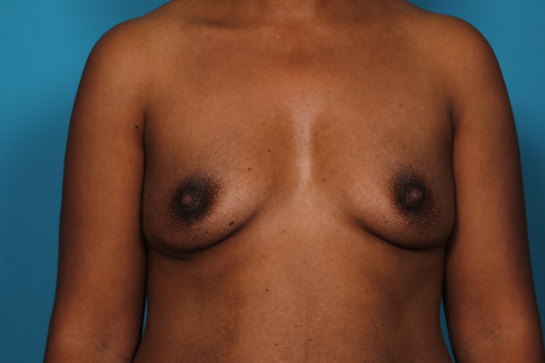 dixon-dione-20161027130237557-20161027131827378-png