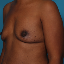 dixon-dione-20161027130237557-20161027131830345-png