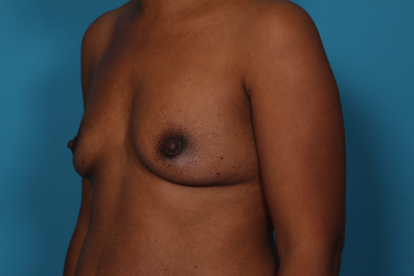 dixon-dione-20161027130237557-20161027131830345-png