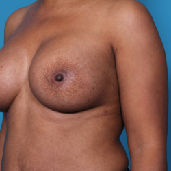 dixon-dione-20161027130237557-20171113151110399-png