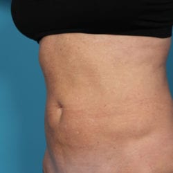 elbaquarteraedit-jpg