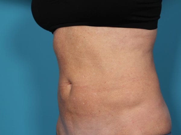 elbaquarteraedit-jpg