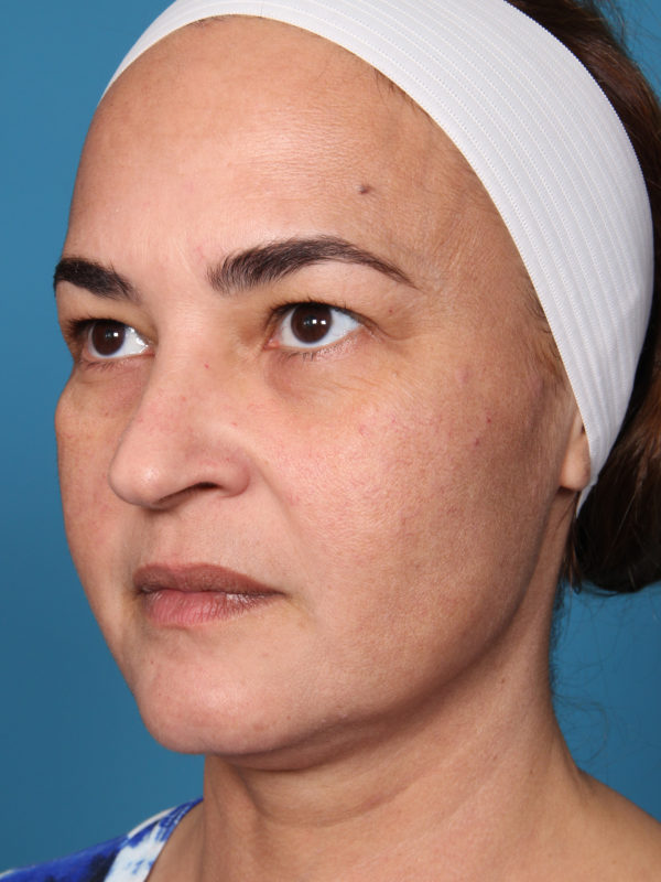 esbaquarteraedit-jpg