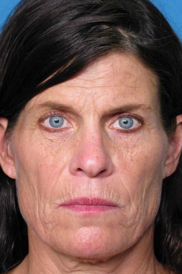 kadafrontbedit-1-jpg