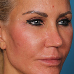 loamquarteraedit-jpg