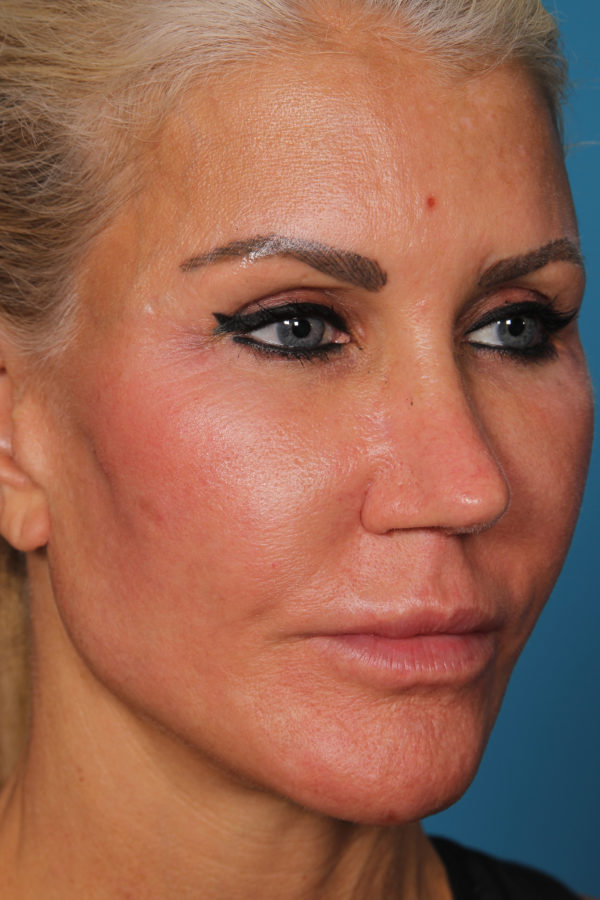 loamquarteraedit-jpg